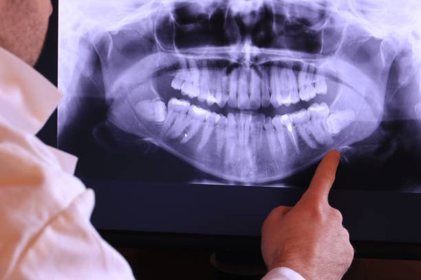 Tooth Infection Emergency Dentist in MT